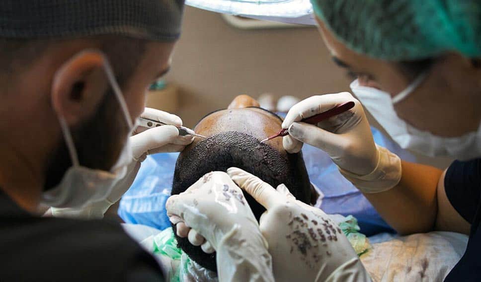 Doctors are transplanting the hair