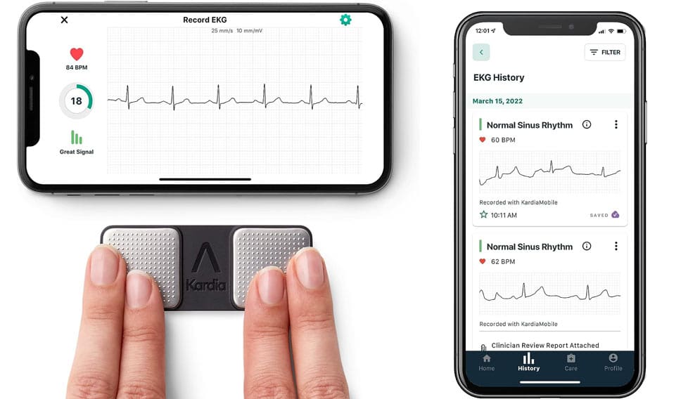 KardiaMobile 1-Lead Personal EKG Monitor