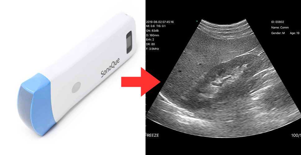 SonoQue o2 Lifecare Wireless Veterinary Ultrasound Scanner Probe